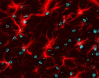 astrocytes