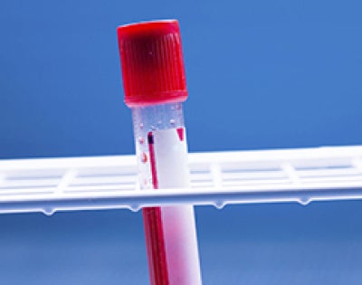 blood-testtube