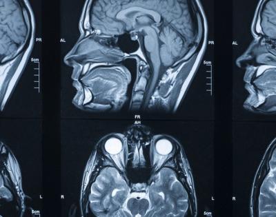 brain-scan-feat