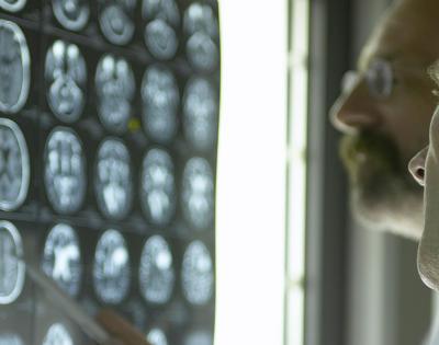 brain-scans-feat