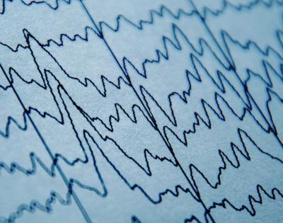 brain-waves
