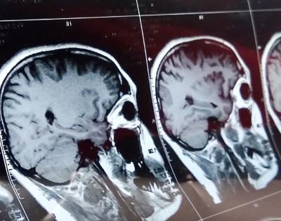 brainwp