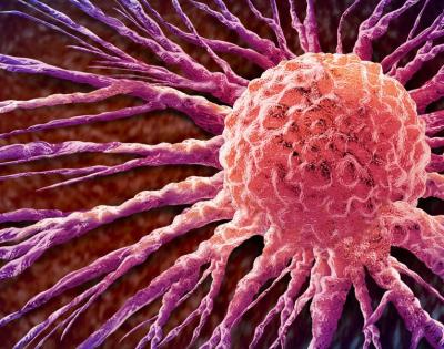 breast-cancer-feat