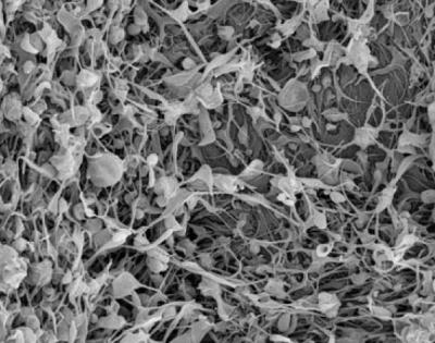 clot-stabilizing-nanotechnology.jpg