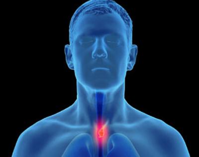 esophagus169.jpg