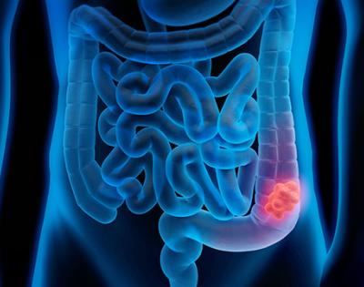 stockgettycolon.jpg