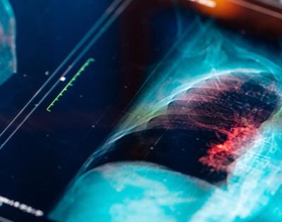 lung-imaging
