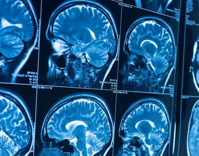mri-scan-feat