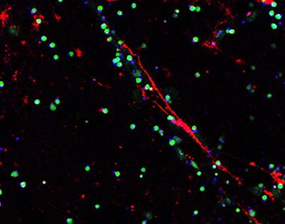 nanoparticles-feat