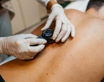 skin-cancer-examination