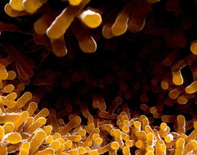 tuberculosis