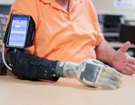 Photo showing a man using an advanced prosthesis