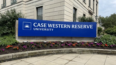 CWRU signage located near Allen Memorial Medical Library