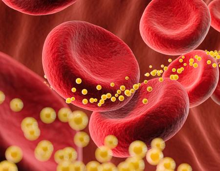Photo illustration of blood cells and cholesterol