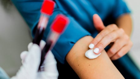 Close-up of patient woman after blood test