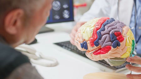 A doctor in a white coat shows a colorful anatomical brain model to an older man in an office setting, conveying a tone of education and care.