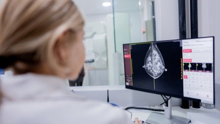 Doctor examining mammography scan on hospital computer