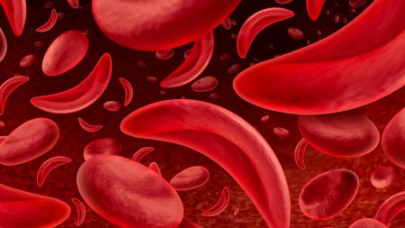 graphic of sickle cells