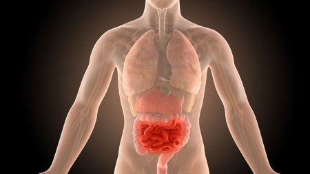 3d-illustration-human-body-crohns-intestines-infection