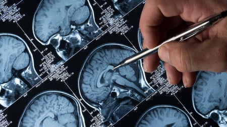 GettyImages-187272969