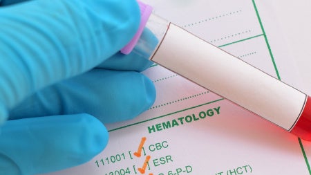 GettyImages-869391124-1