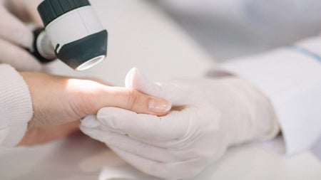 Skin-Testing