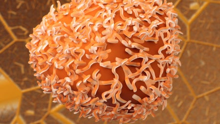colon-cancer-cells