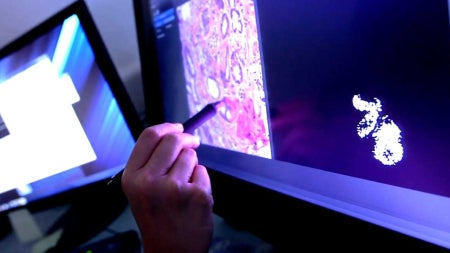 doctor-scans-cancer-feat