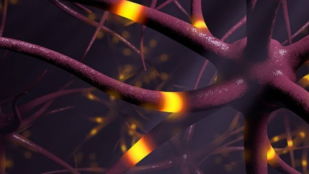 epilepsy_nerves