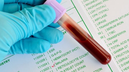 malaria-testing-feat