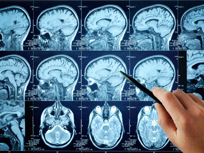 Photo of brain scans for medical research.