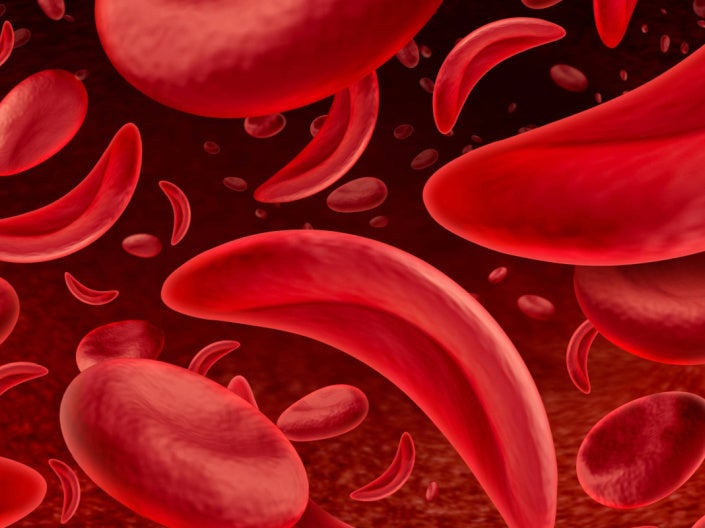 graphic of sickle cells