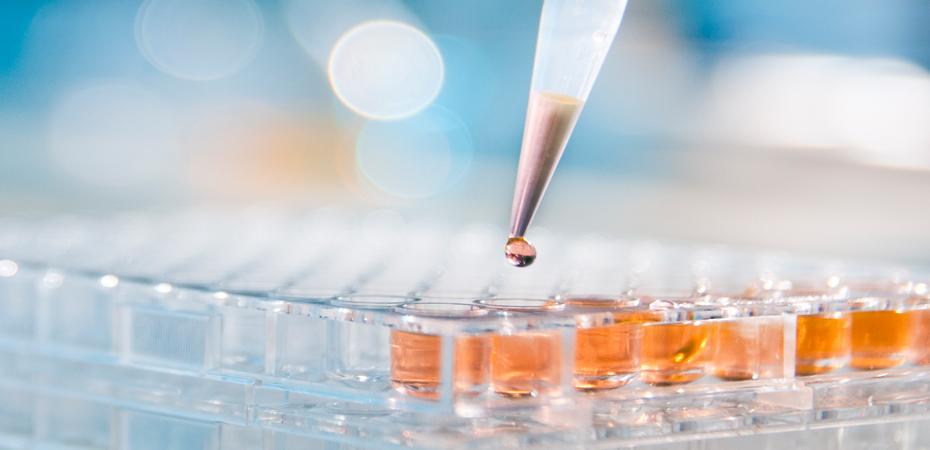 Dropper/pipette with liquid hovering over test tubes