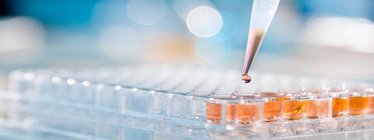 Dropper/pipette with liquid hovering over test tubes