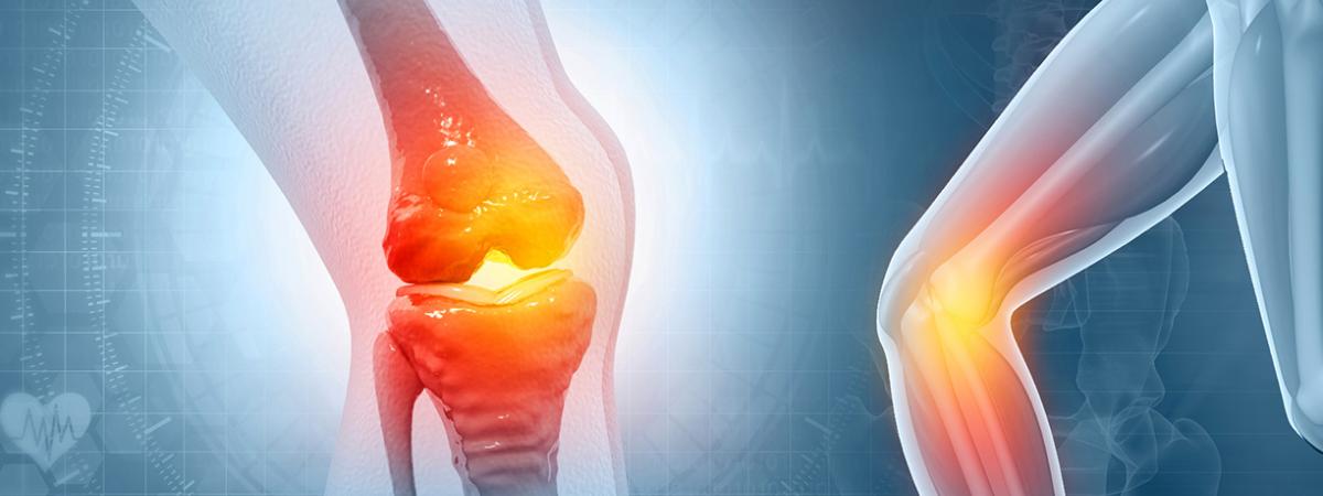 Graphic of knee joint
