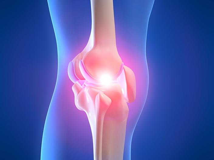 Graphic of a body's joint