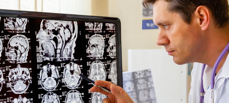 Doctor in white coat examining brain scan on computer.