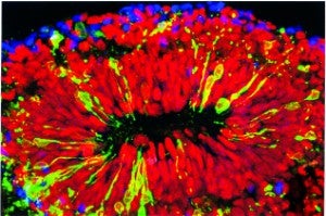 A close-up of a minibrain: primarily thick, red lines extending from a black center intermixed with yellow and blue