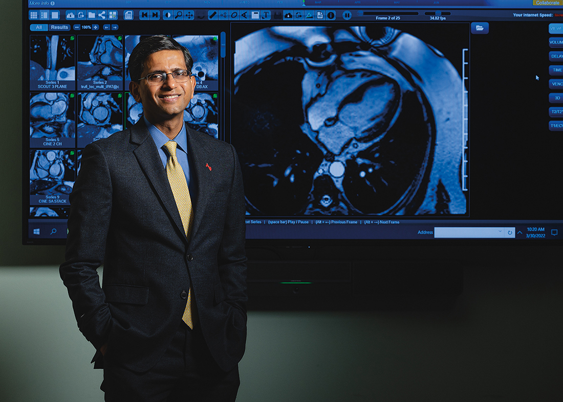 Photo of Sanjay Rajagopalan in front of different screens of MRI heart scans.