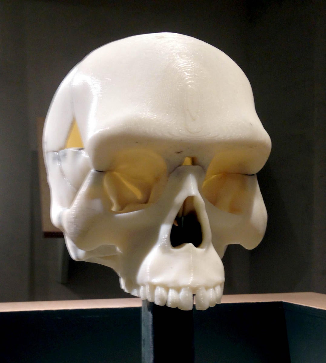 Image of a 3D printed skull 