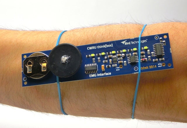 Image of solder kit tied to a man's arm 